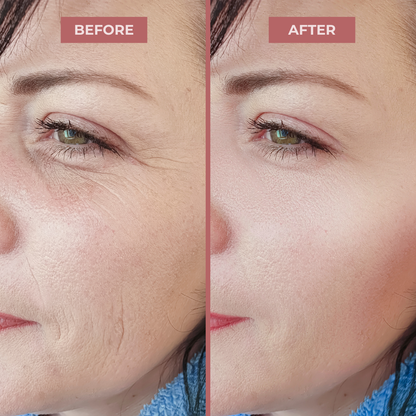 Cemenrete Calcium Balm